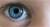 Câncer nos olhos mais comum em crianças pode ser detectado precocemente em exame